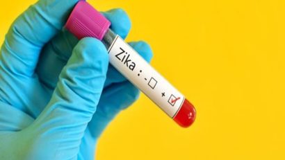 Virusul Zika duce la restricţionarea transfuziilor de sânge, în Franţa